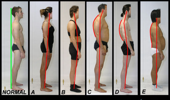 posture-osteopathie